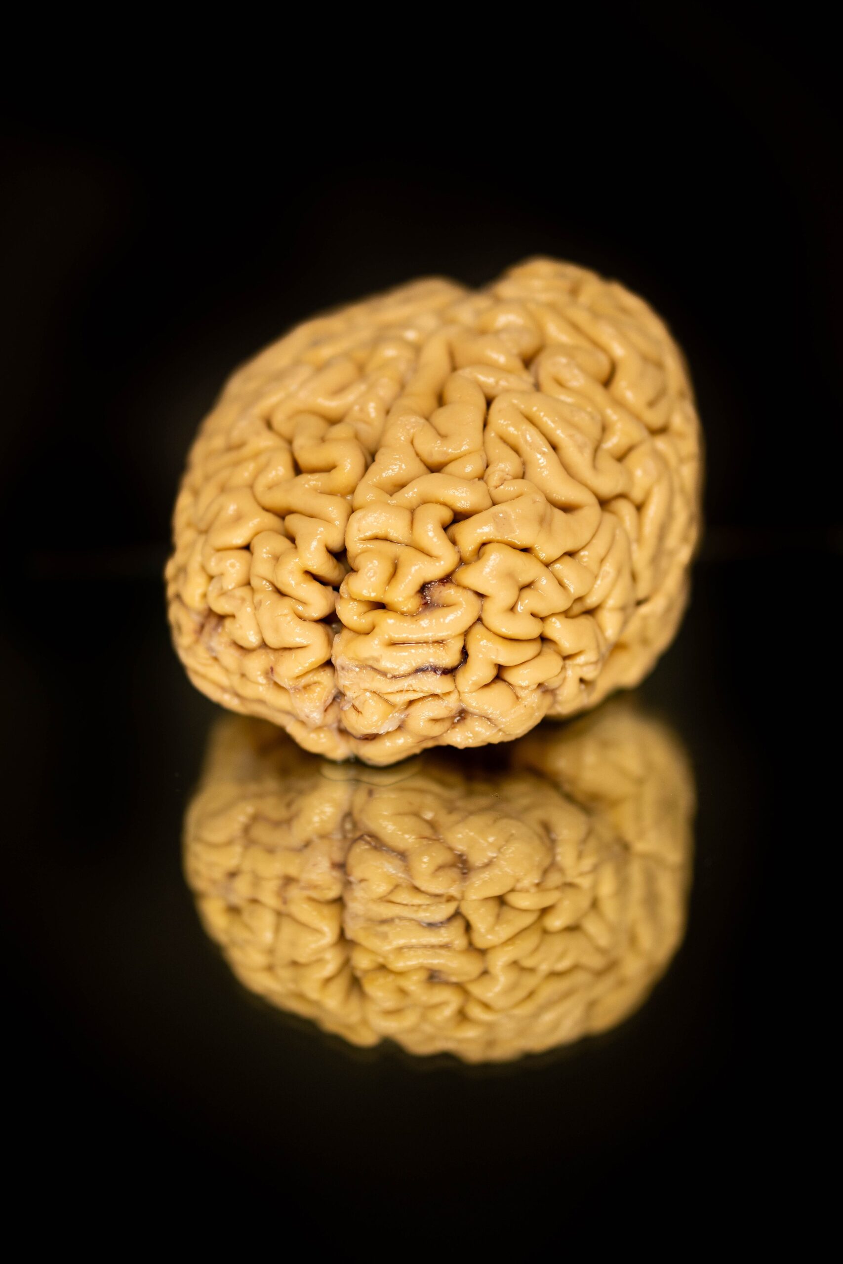 <i>From Shane Collins/Northwestern University via CNN Newsource</i><br/>Researchers at Northwestern University have been studying the brains of SuperAgers for 25 years.