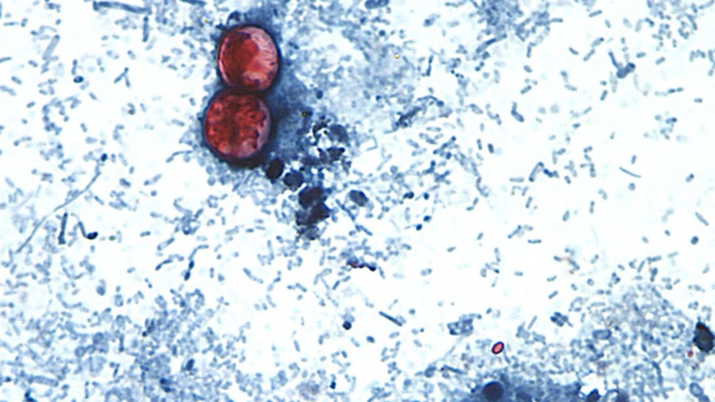 <i>Melanie Moser/CDC/DPDx via CNN Newsource</i><br/>Cases of cyclosporiasis are known to rise during spring and summer months in the US