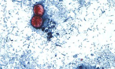 Cases of cyclosporiasis are known to rise during spring and summer months in the US