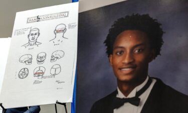 Diagrams depicting preliminary findings from Nolan Wells' independent autopsy are shown during a press conference Wednesday.