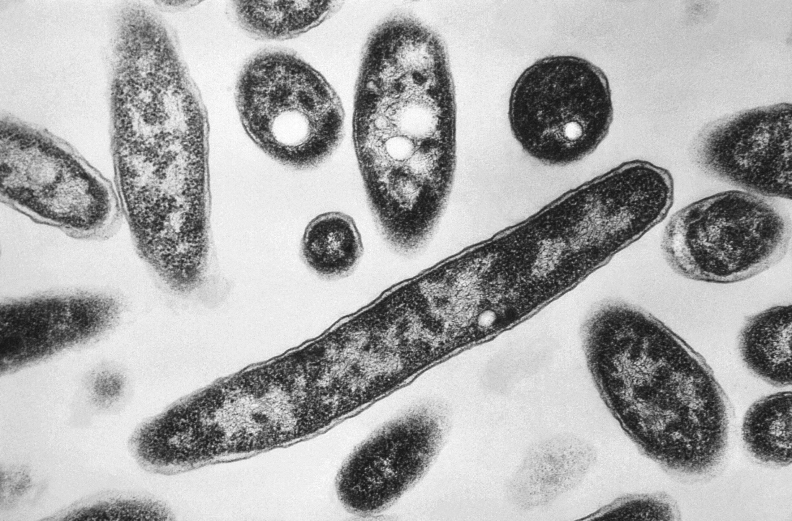 <i>Barry Williams/New York Daily News/Tribune News Service via Getty Images via CNN Newsource</i><br/>New York City Health Commissioner Dr. Alister Martin speaks at a town hall concerning the Legionnaires' disease cluster on July 7 in New York.