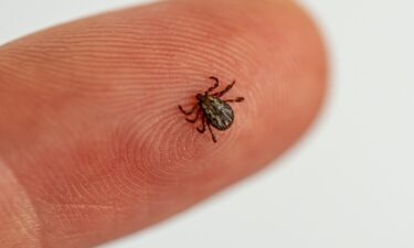 Tick bite symptoms: What to watch for in the days after a bite