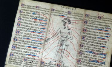 Urine analysis was one of the most popular tests used to diagnose medieval patients