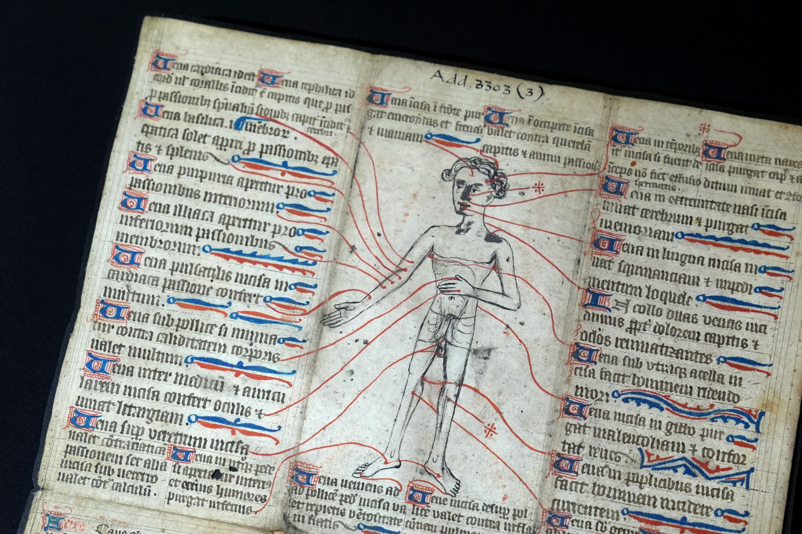 <i>Art Images/Hulton Fine Art Collection/Getty Images via CNN Newsource</i><br/>Urine analysis was one of the most popular tests used to diagnose medieval patients