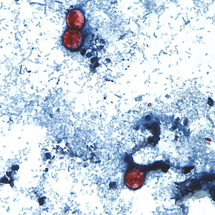 <i>Melanie Moser/CDC/AP via CNN Newsource</i><br/>Michigan has reported more than 11