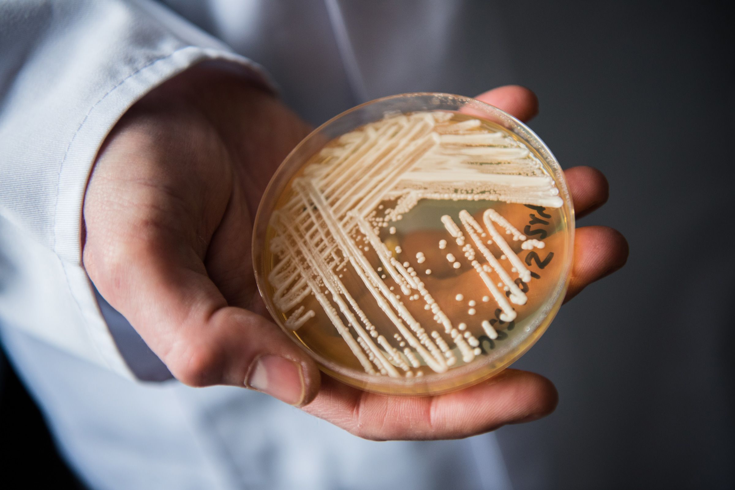 <i>Nicolas Armer/picture alliance via Getty Images via CNN Newsource</i><br/>Candida auris is primarily a concern for people who are hospitalized.