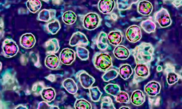 This photo shows a microscopic view of the measles virus.