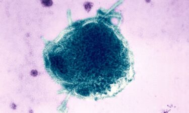 The Pennsylvania Department of Health this week recorded its first two measles-associated deaths in 35 years