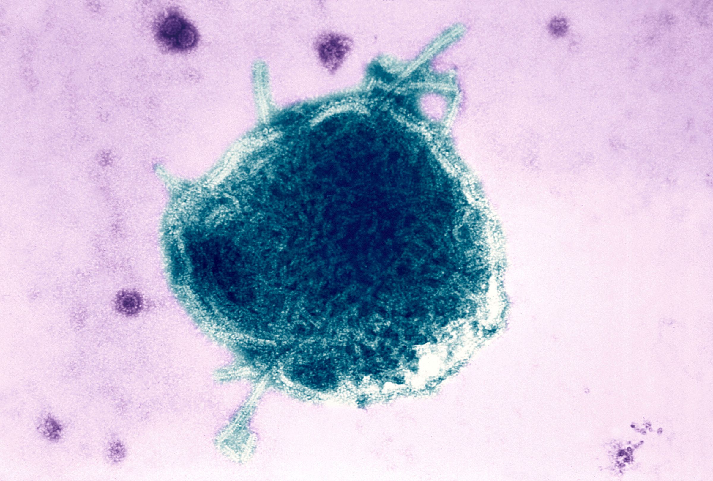 <i>BSIP/UIG/Getty Images via CNN Newsource</i><br/>The Pennsylvania Department of Health this week recorded its first two measles-associated deaths in 35 years
