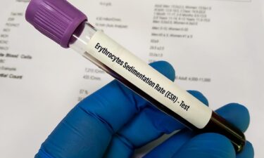 Why are labs still running a test for inflammation with a 4-hour time limit?