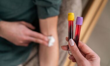 Lower levels of liver enzymes were linked to greater risk of early-onset colorectal cancer in a new analysis