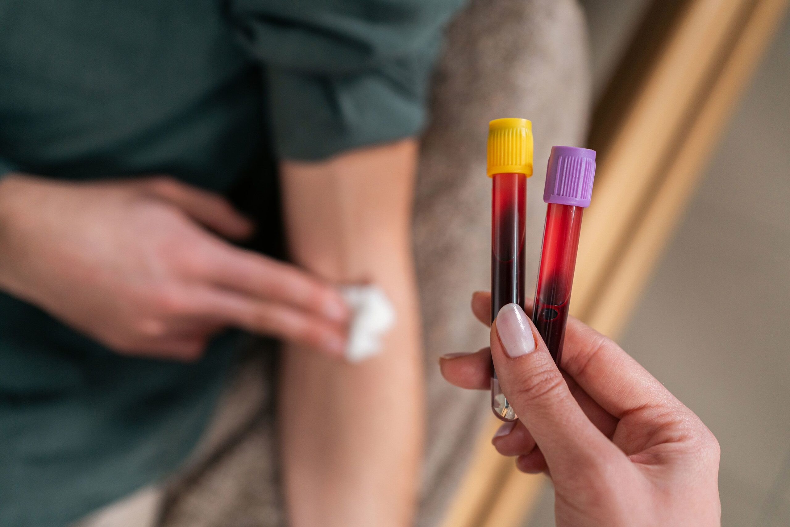 <i>FluxFactory/E+/Getty Images/File via CNN Newsource</i><br/>Lower levels of liver enzymes were linked to greater risk of early-onset colorectal cancer in a new analysis