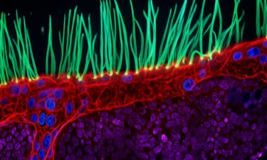 A stunning video capturing intricate cell movement in a child living with a rare genetic disorder has won the 16th annual Nikon Small World in Motion competition.