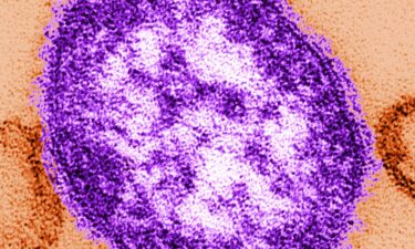 Pennsylvania reported a fifth death related to measles amid an ongoing outbreak.