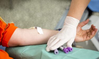 What is apolipoprotein B? The cholesterol test many people don&rsquo;t know about