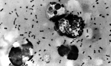 Three of the world’s deadliest pandemics have been blamed on Yersinia pestis