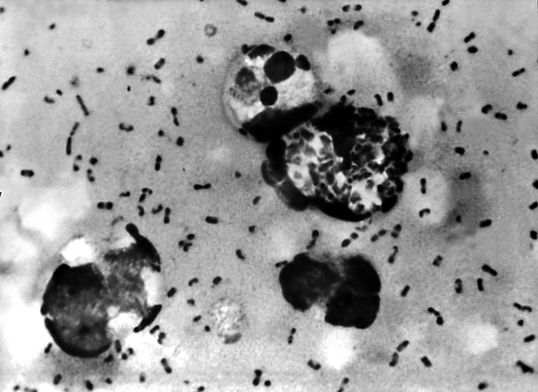 <i>CDC via CNN Newsource</i><br/>Three of the world’s deadliest pandemics have been blamed on Yersinia pestis