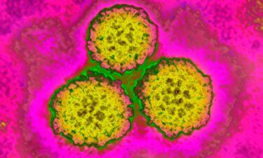 Human papilloma virus or HPV is one of several infections that scientists connected to about 2.3 million new cancer cases globally in 2024