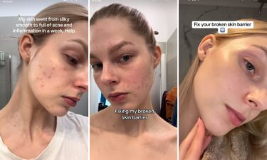 The “glass skin” social media trend promises a dewy glow