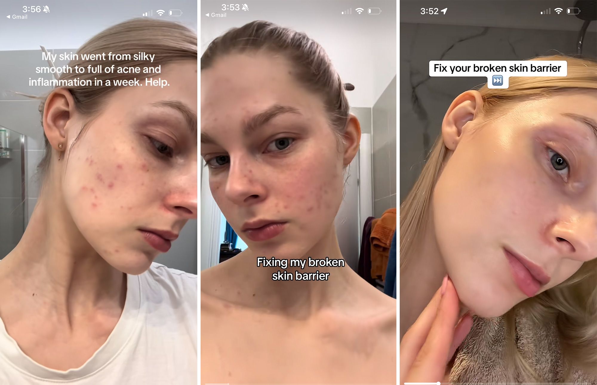 <i>Greta Costioli via CNN Newsource</i><br/>The “glass skin” social media trend promises a dewy glow